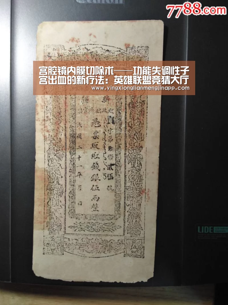 宫腔镜内膜切除术——功能失调性子宫出血的新疗法:英雄联盟竞猜大厅 - LOL全球总决赛下注官方网站直播(图3) 英雄联盟竞猜大厅 - LOL全球总决赛下注官方网站下载